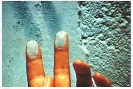 66fb1694f503ddea0676587b Chalking